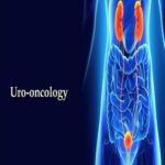 Blog on Uro-Oncology