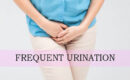 Frequent urination in women
