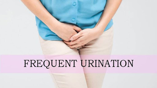 Frequent urination in women