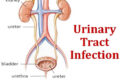 urinary tract infection treatment