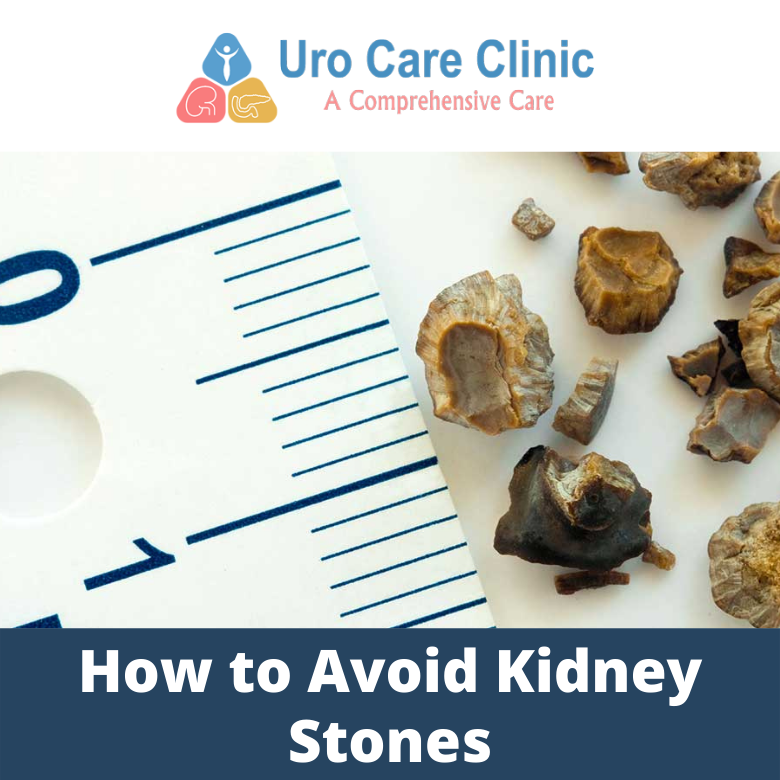 How to Avoid Kidney Stones